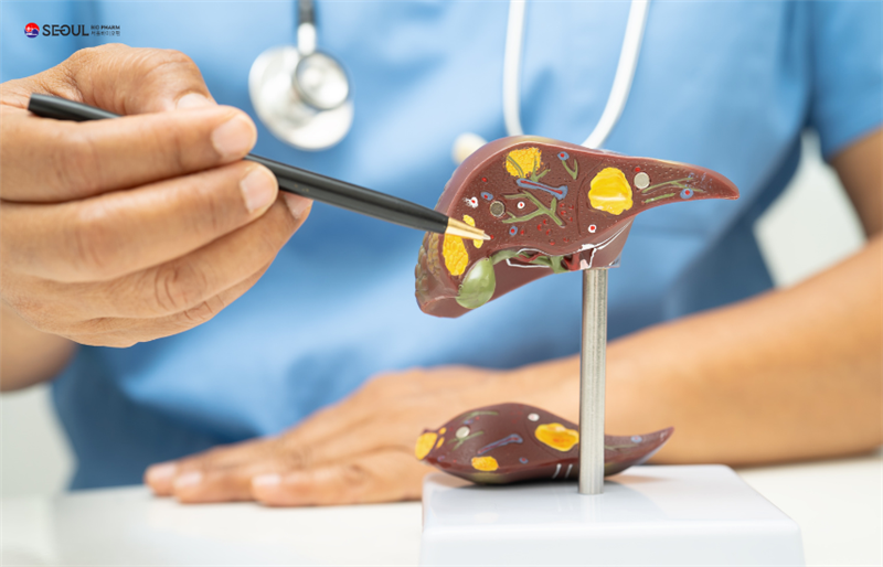 Vì sao nhiều người trẻ đã bị gan nhiễm mỡ, tăng men gan?